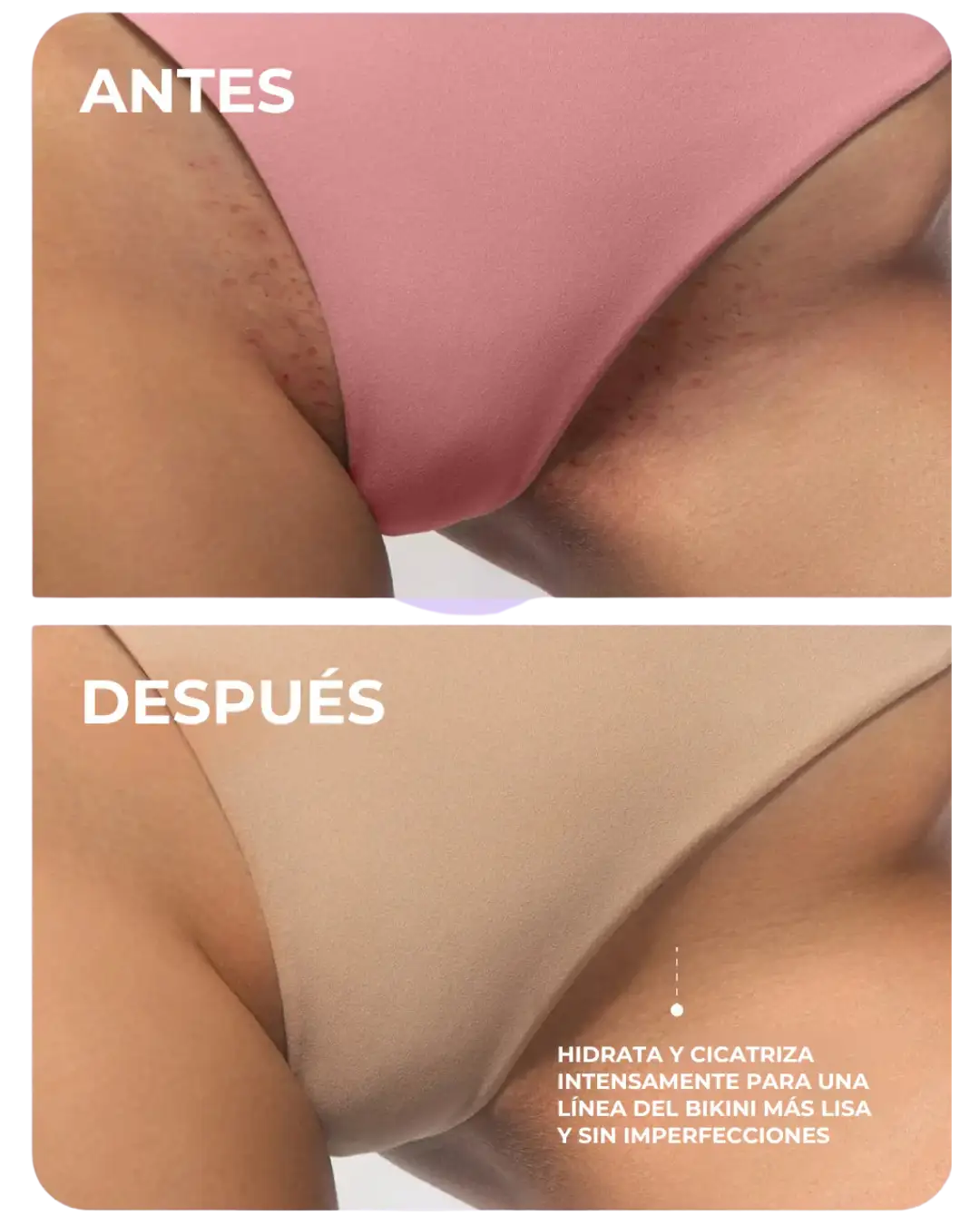 Aceite Íntimo 100% Natural – Suavidad, Hidratación y Prevención de Irritación