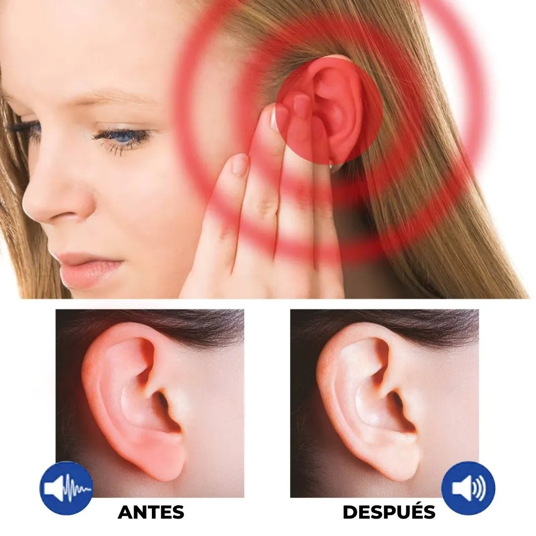 Antes y despues TinniDrop