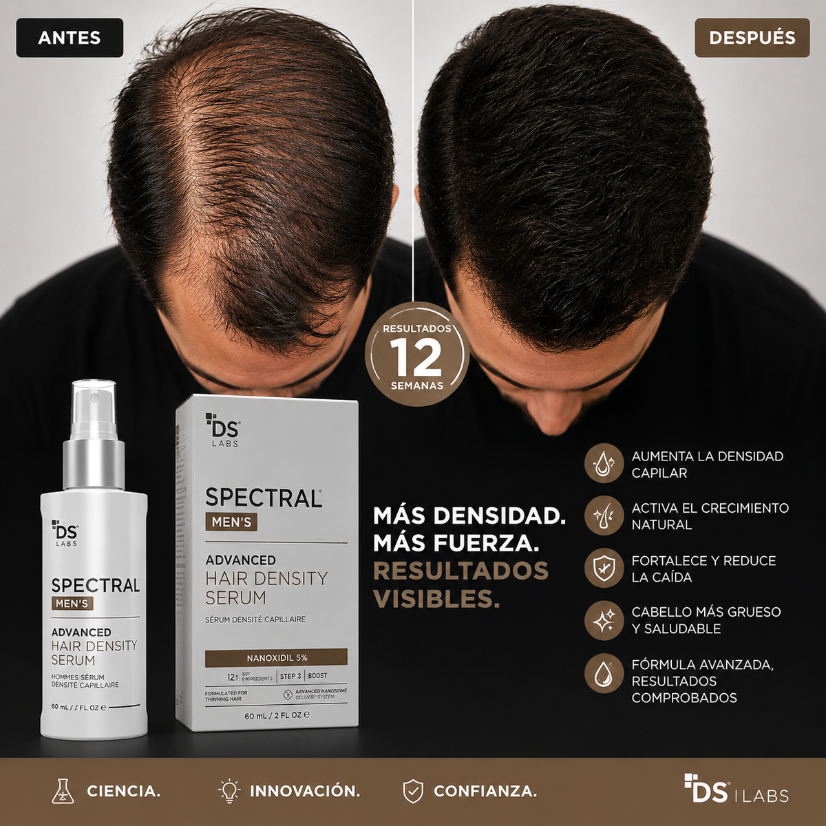 Spectral DNC-N — Serum Redensificador con Nanoxidil 5%