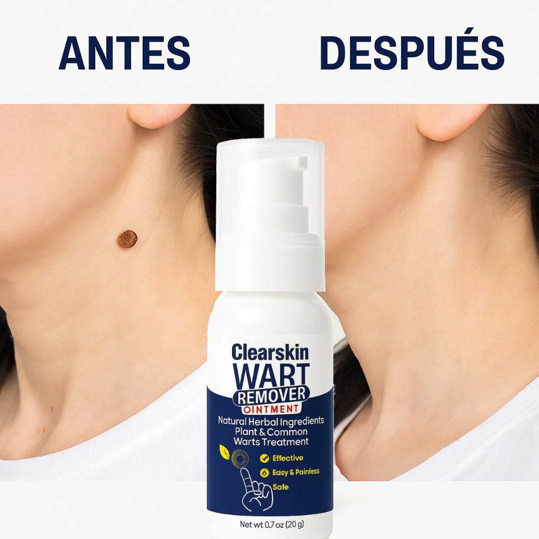 CLEARSKIN WART REMOVER™ | Di adiós a las verrugas y lunares