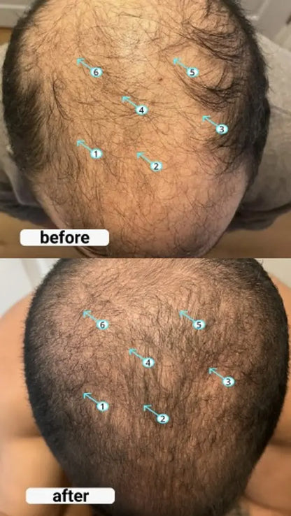 Resultados antes y despues - parte superior